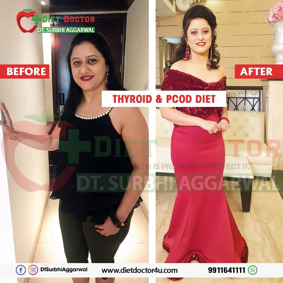 Thyroid PCOD Diet