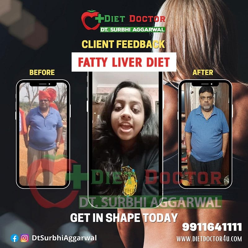 Best Dietician in Delhi