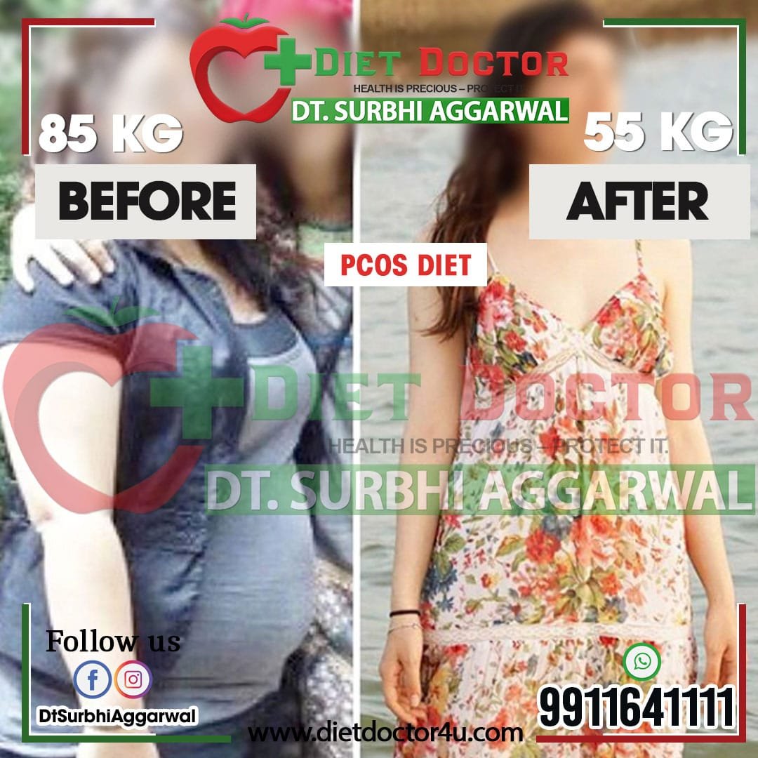 Best Dietician in Delhi