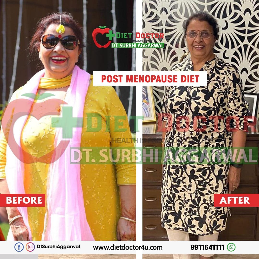 Best Dietician in Delhi