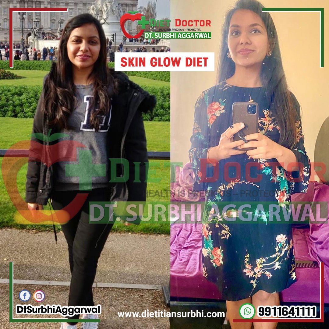 Best Dietician in Delhi