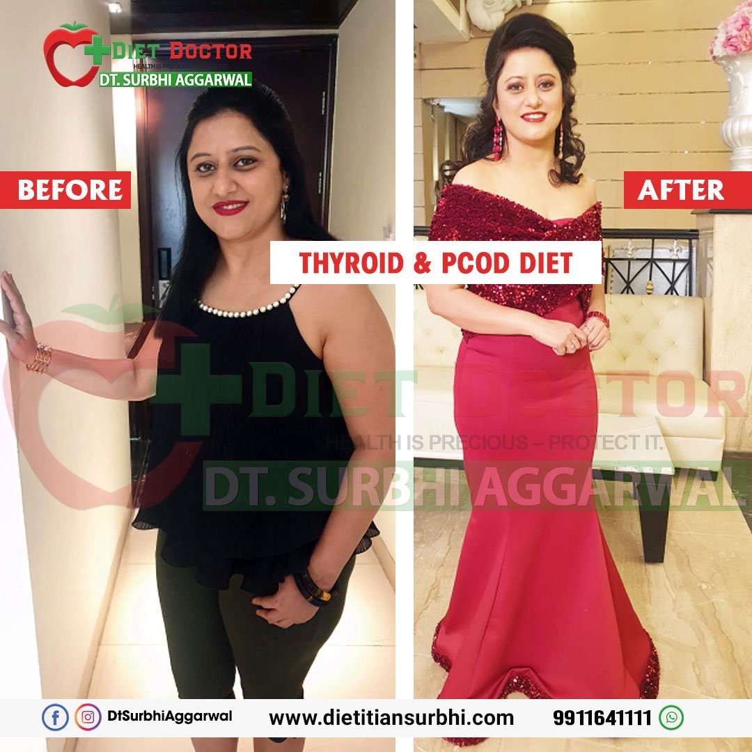 dietitian surbhi Aggarwal best dietitian transformation