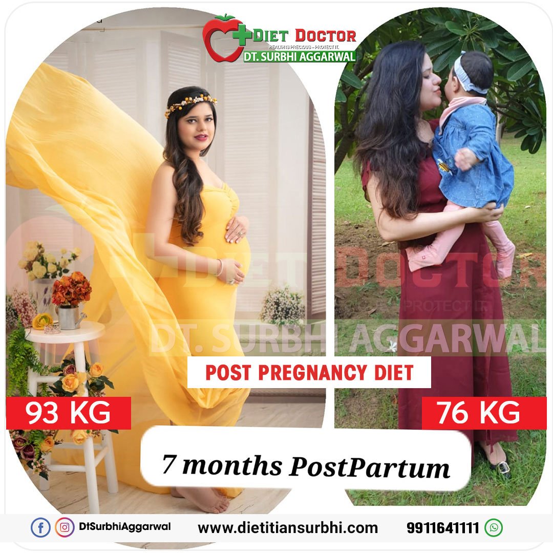 dietitian surbhi Aggarwal best dietitian transformation